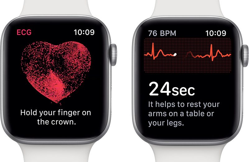 apple watch ecg Kommentarmesse för EKG avec l 'Apple Watch