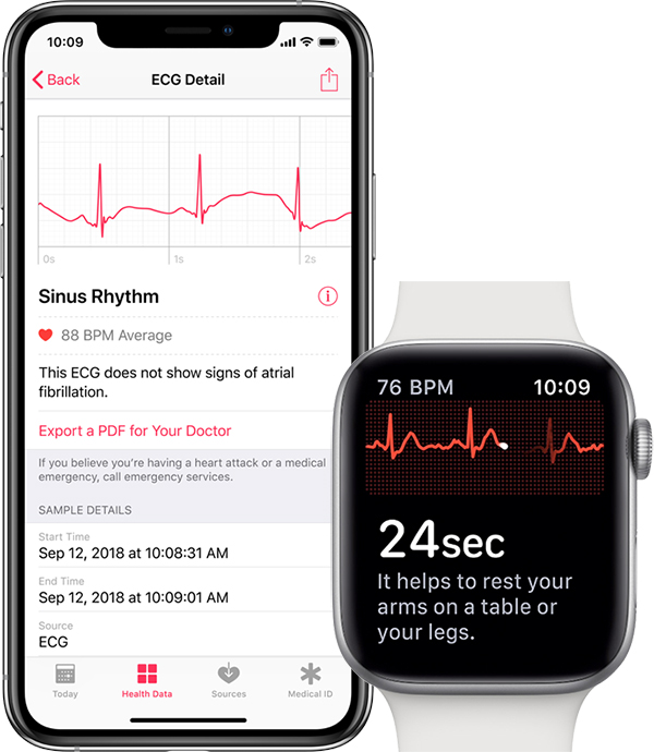 apple ecg export pdf medecin Kommentarer faire un ECG avec l 'Apple Watch