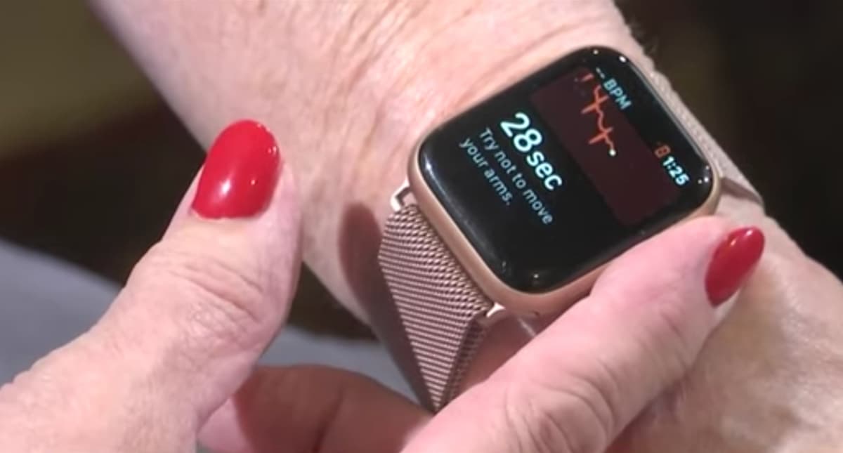 Imagem Apple Watch Serie 4 que detetou Fibrilhação auricular a uma mulher do Alabama