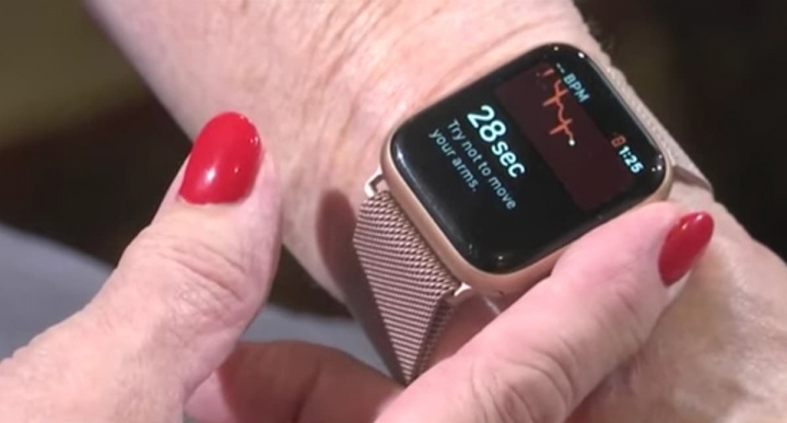 Gambar Apple Watch Serie 4 Mendeteksi Fibrilasi Atrium untuk Wanita Alabama