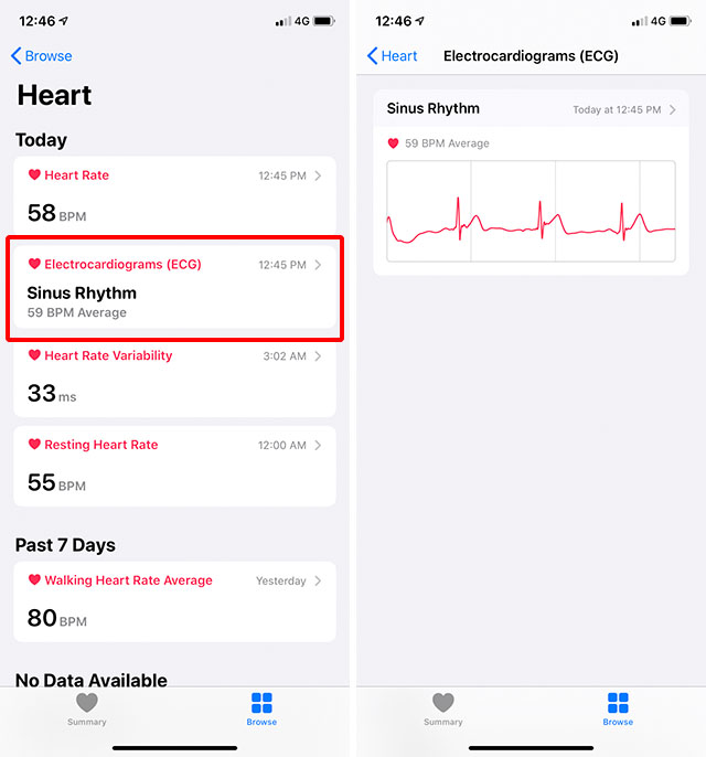 Menggunakan Apple Watch Fitur EKG yang efektif