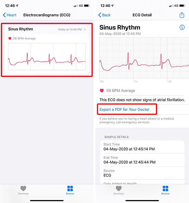 Cách sử dụng Apple Watch Tính năng ECG hiệu quả